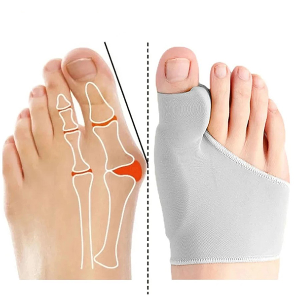 Silicone Gel Bunion Valgus Corrector (1 Pair)